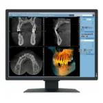 EIZO RadiForce MX217-SB Monitor PC 53,3 cm (21") 1200 x 1600 Pixel UXGA LCD Nero
